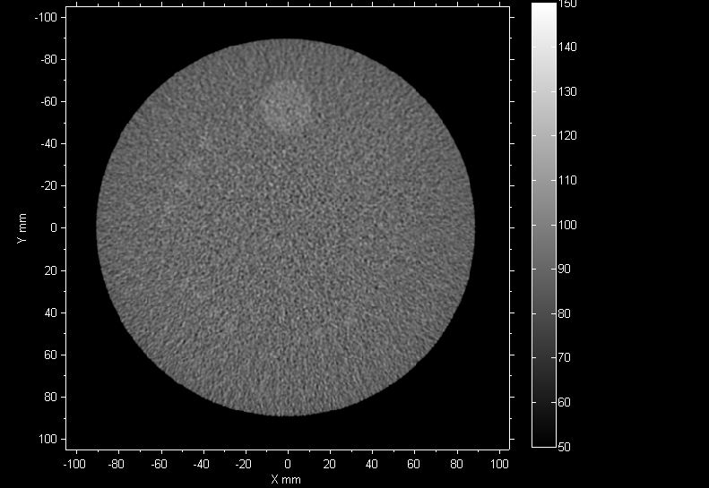 Low Contrast Detectability and Geometric Accuracy, Distortion, Artifacts and Distance Measurements