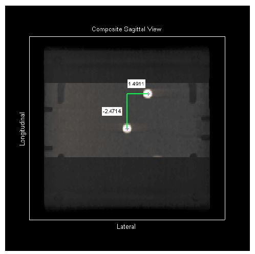 ISO Cube CBCT sagittal image