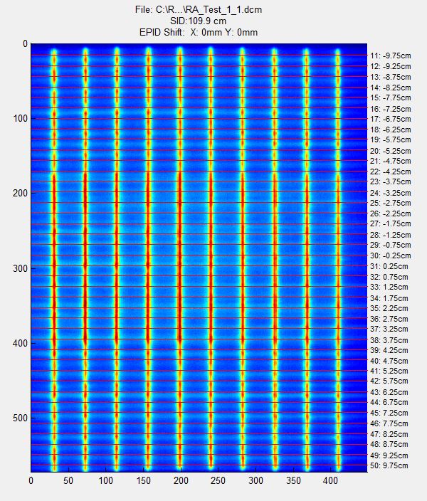 Varian RapidArc® test 1.1 EPID image