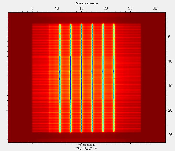 Varian RapidArc® test 1.2 EPID image