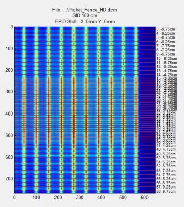 EPID picket fence analysis