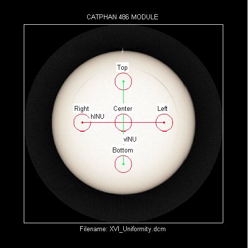 Elekta XVI 486 analyzed image