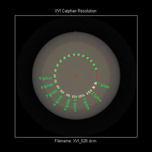 Elekta XVI resolution analyzed image